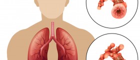 What Every COPD Patient Should Know About Portable Oxygen Therapy