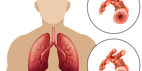 What Every COPD Patient Should Know About Portable Oxygen Therapy