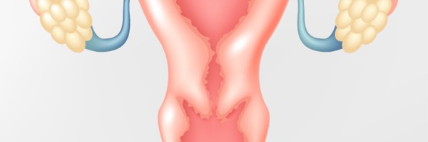 What Every Woman With Endometriosis Should Know About Ovarian Cancer