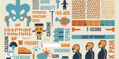 What Is A Bone Mineral Density (BMD) Test And What Do The Results Mean?