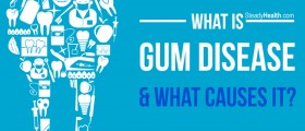 What Is Gum Disease And What Causes It?