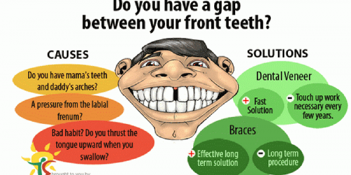 What to Do About a Gap Between Your Front Teeth