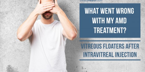 My Macular Degeneration Treatment: Vitreous Floaters after Intravitreal Injection