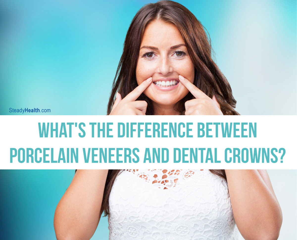 What's The Difference Between Porcelain Veneers And Dental Crowns ...