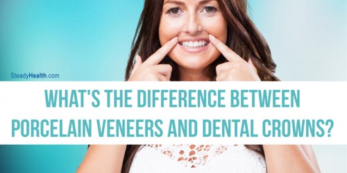 What's The Difference Between Porcelain Veneers And Dental Crowns?