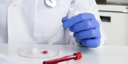 White Blood Cell Count High: Scared? Here's What You Need To Know