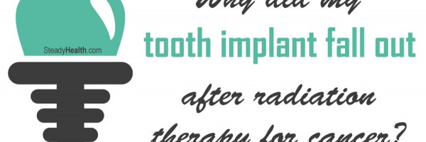 Why Did My Tooth Implant Fall Out After Radiation Therapy For Cancer?