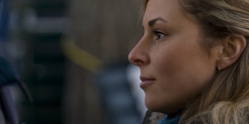 Thinking Of Having A Chemical Peel?