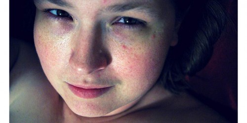 Alarming Number Of Young Women Seek To Reshape Their Private Parts