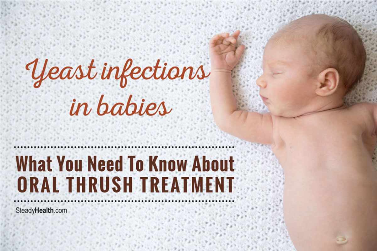 Yeast Infections In Babies What Do You Need To Know About Treatment