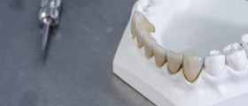 Zirconia White Dental Crowns For Kids: What Should You Know?