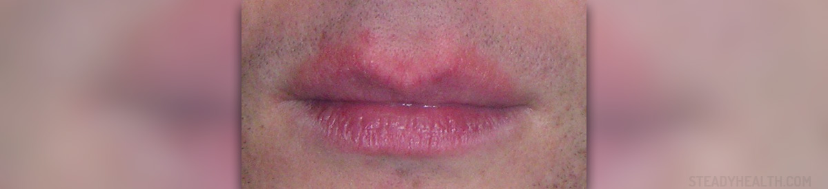 home remedies for chapped lips overnight