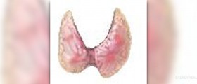 A lump in the throat and thyroid gland disorders