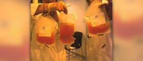 About acute cytomegalovirus