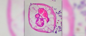 About appendix function