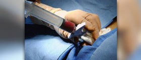 About benign paraproteinaemia
