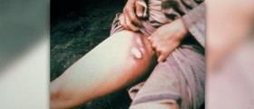 About bubonic plague