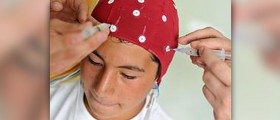 About concussion treatment