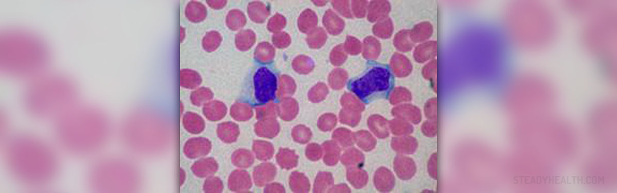 About high lymphocytes | Cardiovascular Disorders and Diseases articles