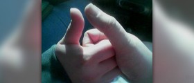 About jammed thumb