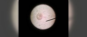 About roundworm facts