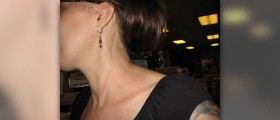 About sagging neck