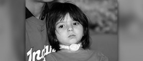 About tracheotomy information
