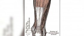 Achilles tendon injury