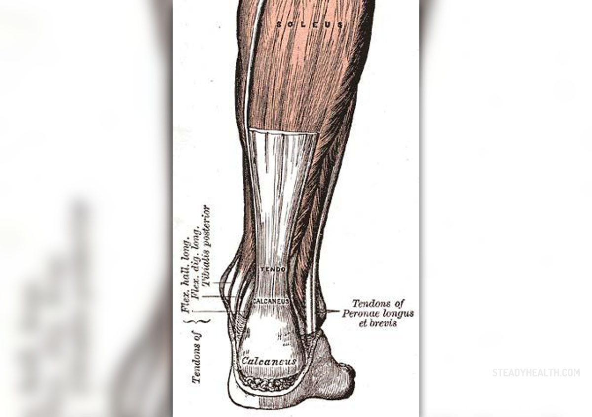 Achilles tenotomy in achilles tendon | Musculoskeletal Issues articles ...