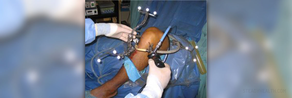 ACL surgery cost Musculoskeletal Issues articles Body