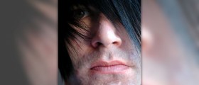 Acne around mouth