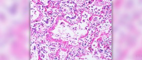 Acute cuticle infection