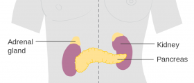 Enlarged adrenal gland