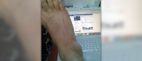 Ankle pain when walking