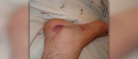 Ankle pain while running