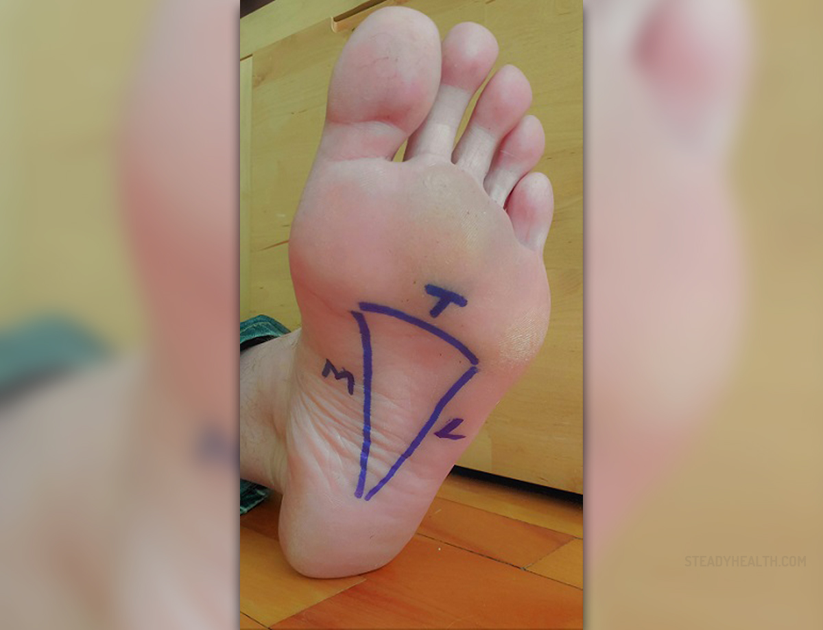 arch pain in foot relief