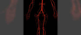 Arterial insufficiency facts