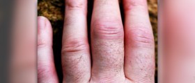 Arthritis exercises - how exercises can reduce arthritic pain