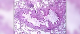 Asthma guidelines for children and adults