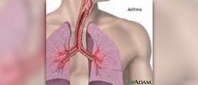 Asthma symptoms in adults