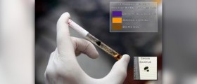 Athlete drug testing