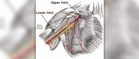 Axillary hyperhidrosis review