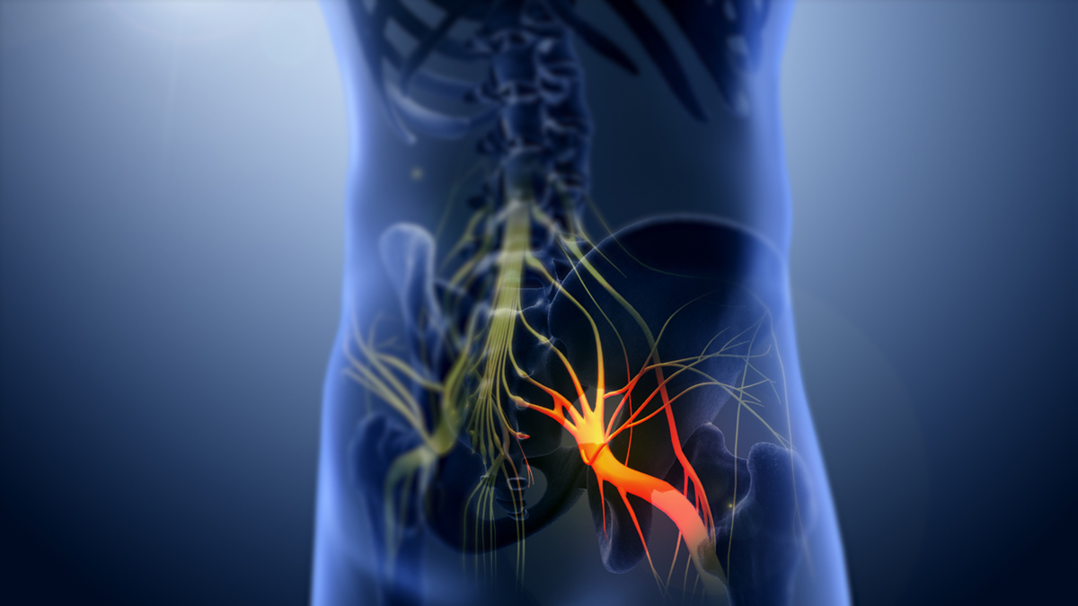Trapped nerve in back | General center | SteadyHealth.com