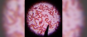 Bacterial Food Poisoning