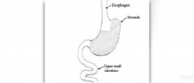 Bacterial infection in stomach