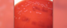 Bacterial meningitis incubation period
