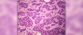 Benign hamartoma breast