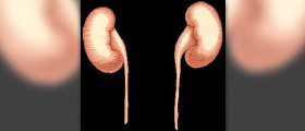 Benign lump on kidney