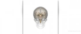 Benign pituitary adenoma