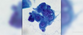 Best medication for genital herpes